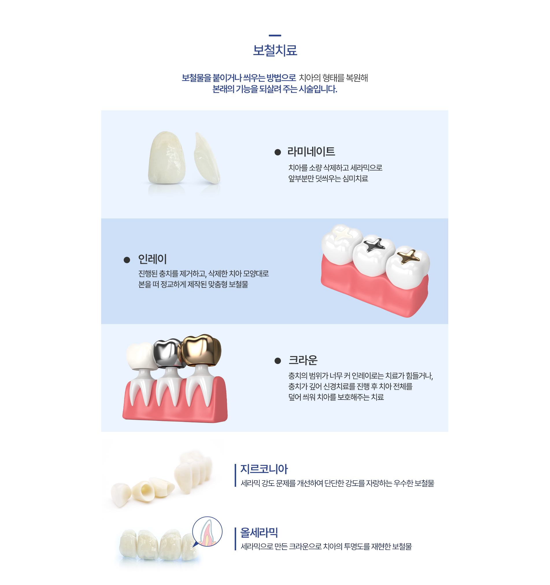 보철치료