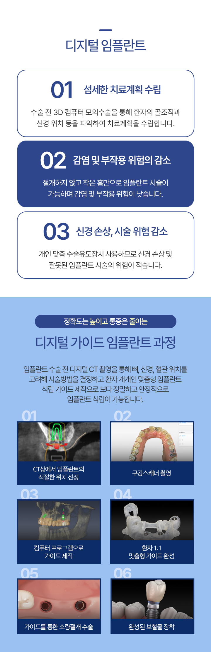 디지털 임플란트