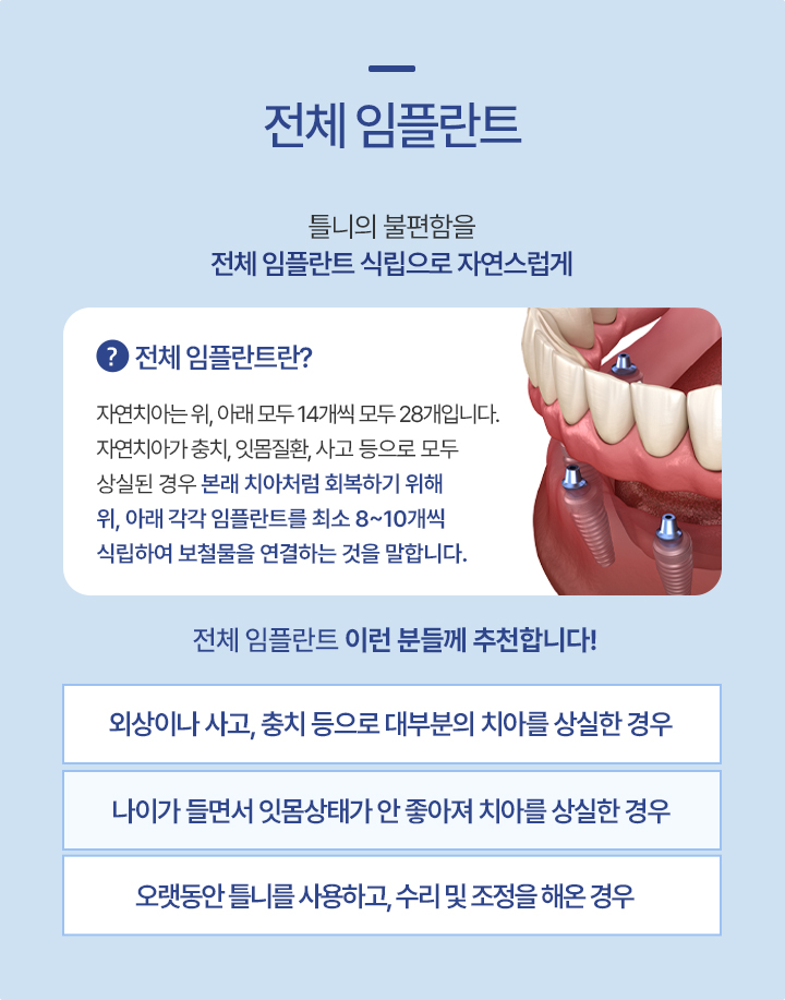 전체 임플란트