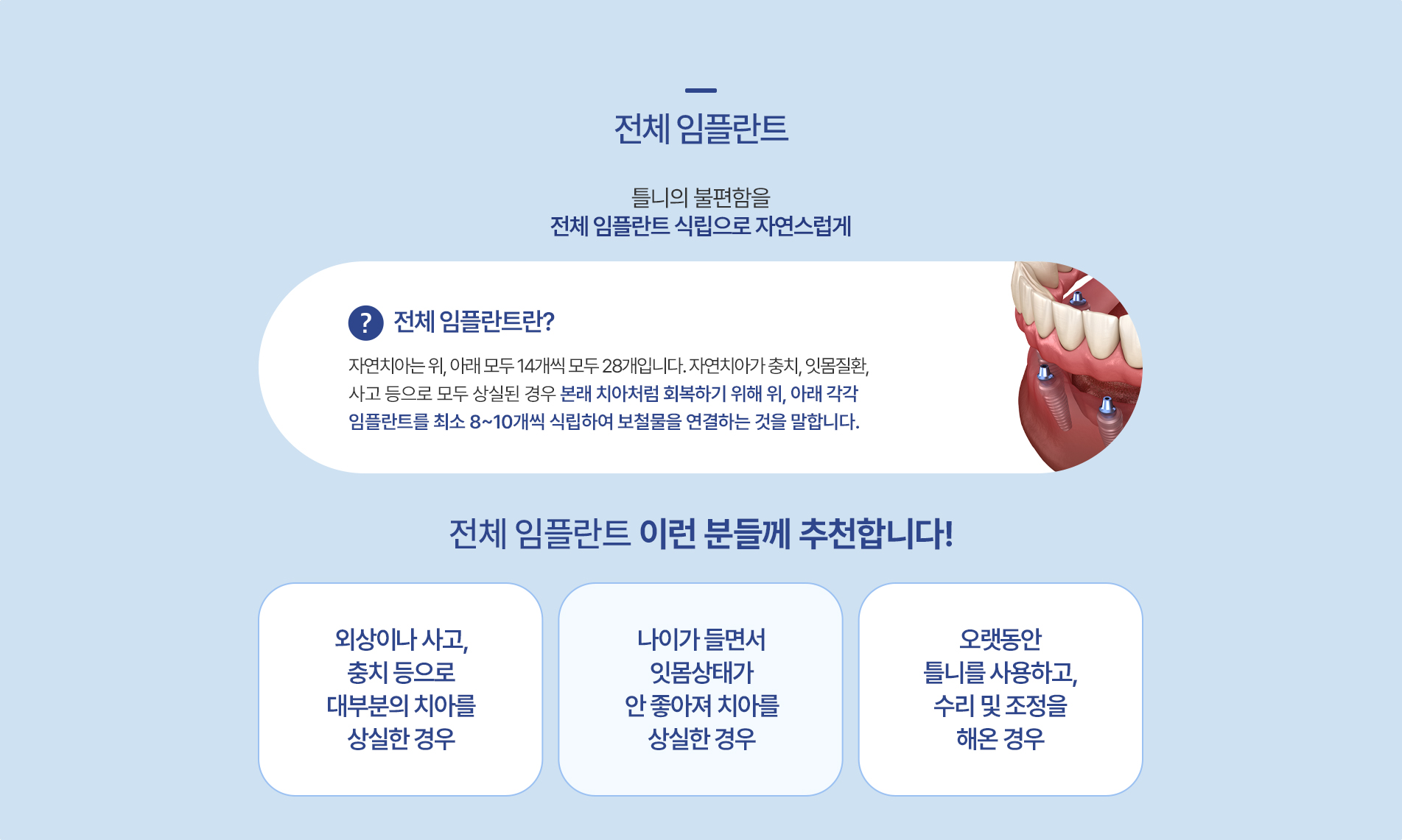 전체 임플란트