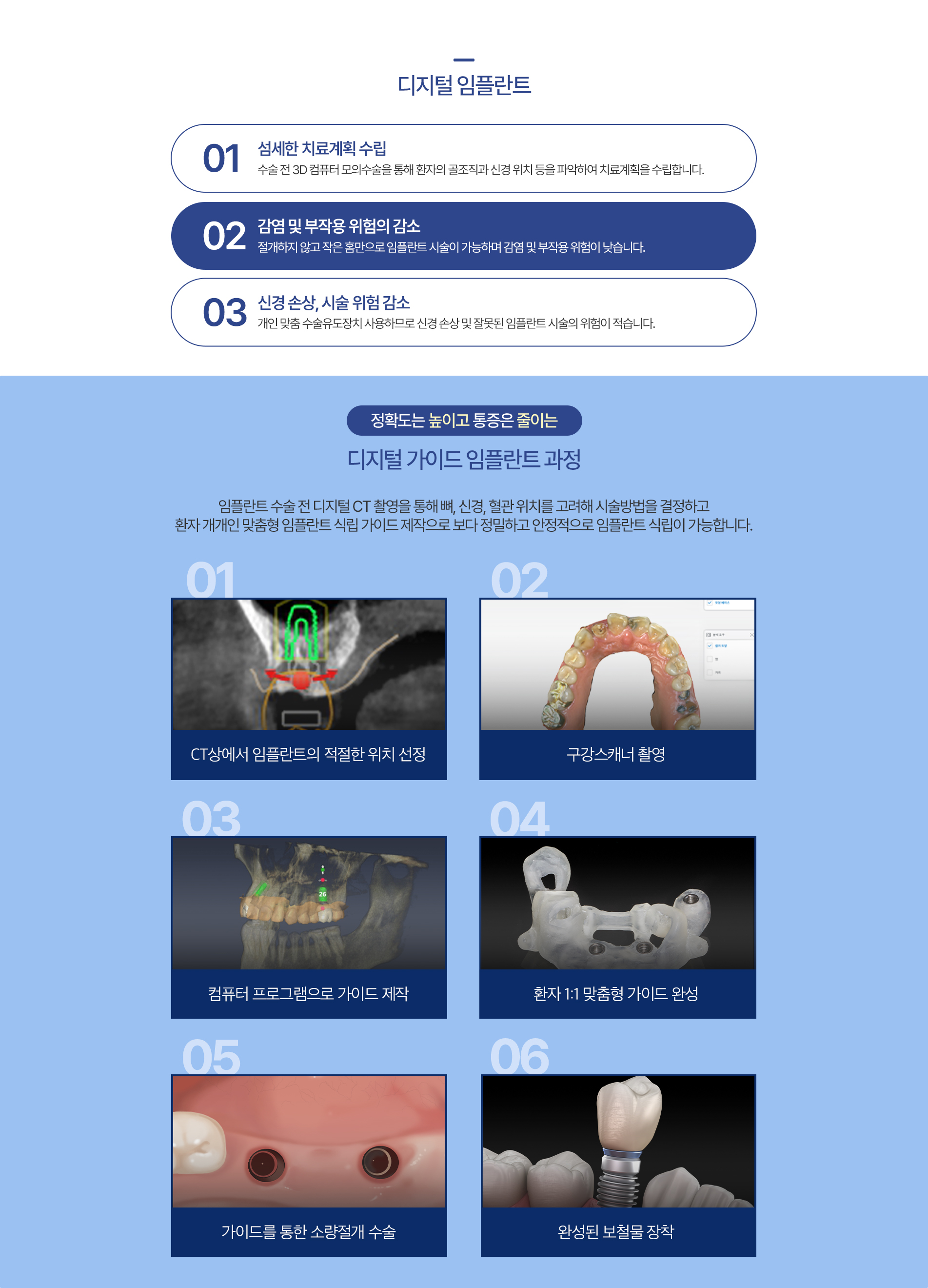 디지털 임플란트