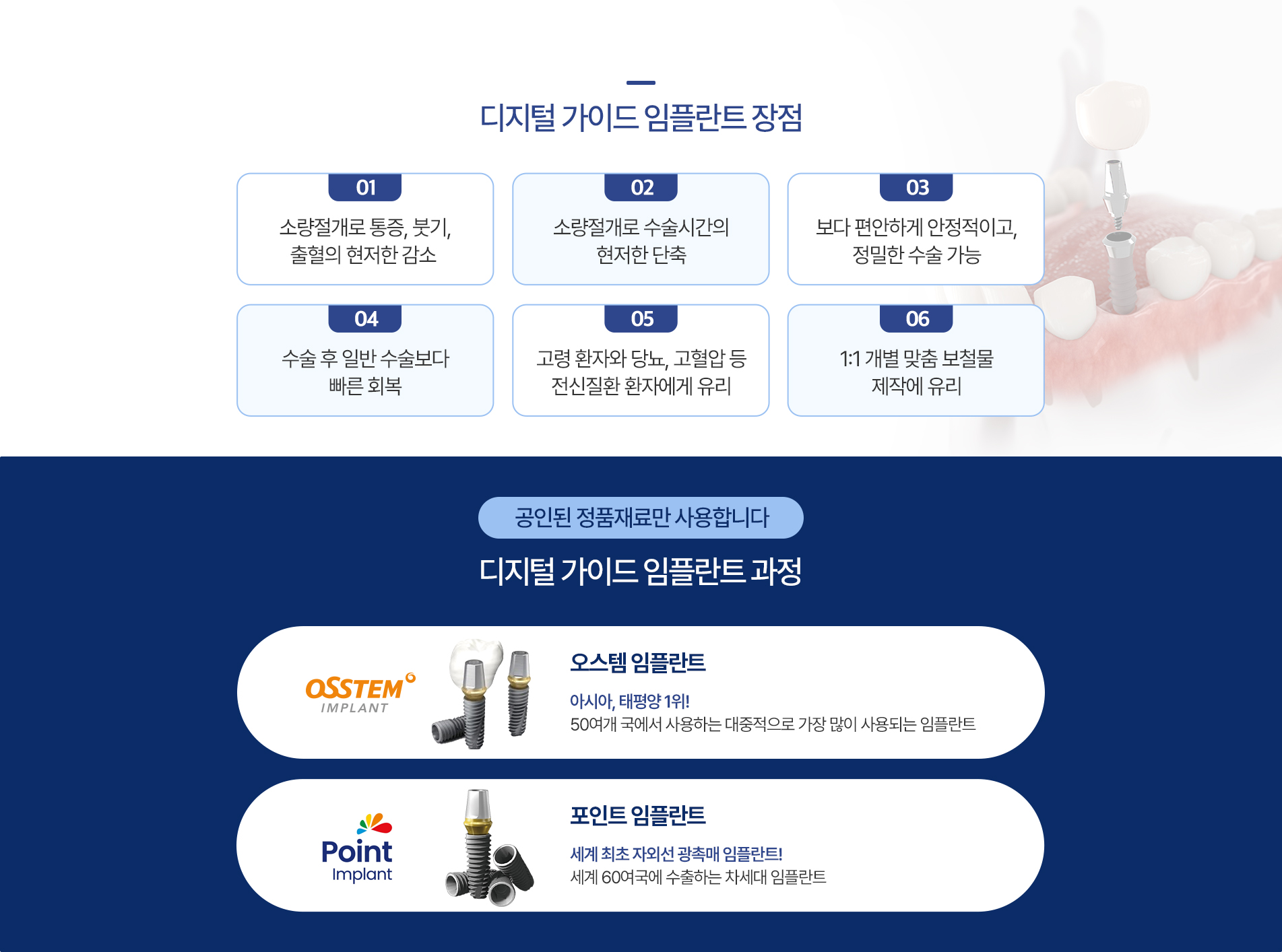 디지털 가이드 임플란트 장점