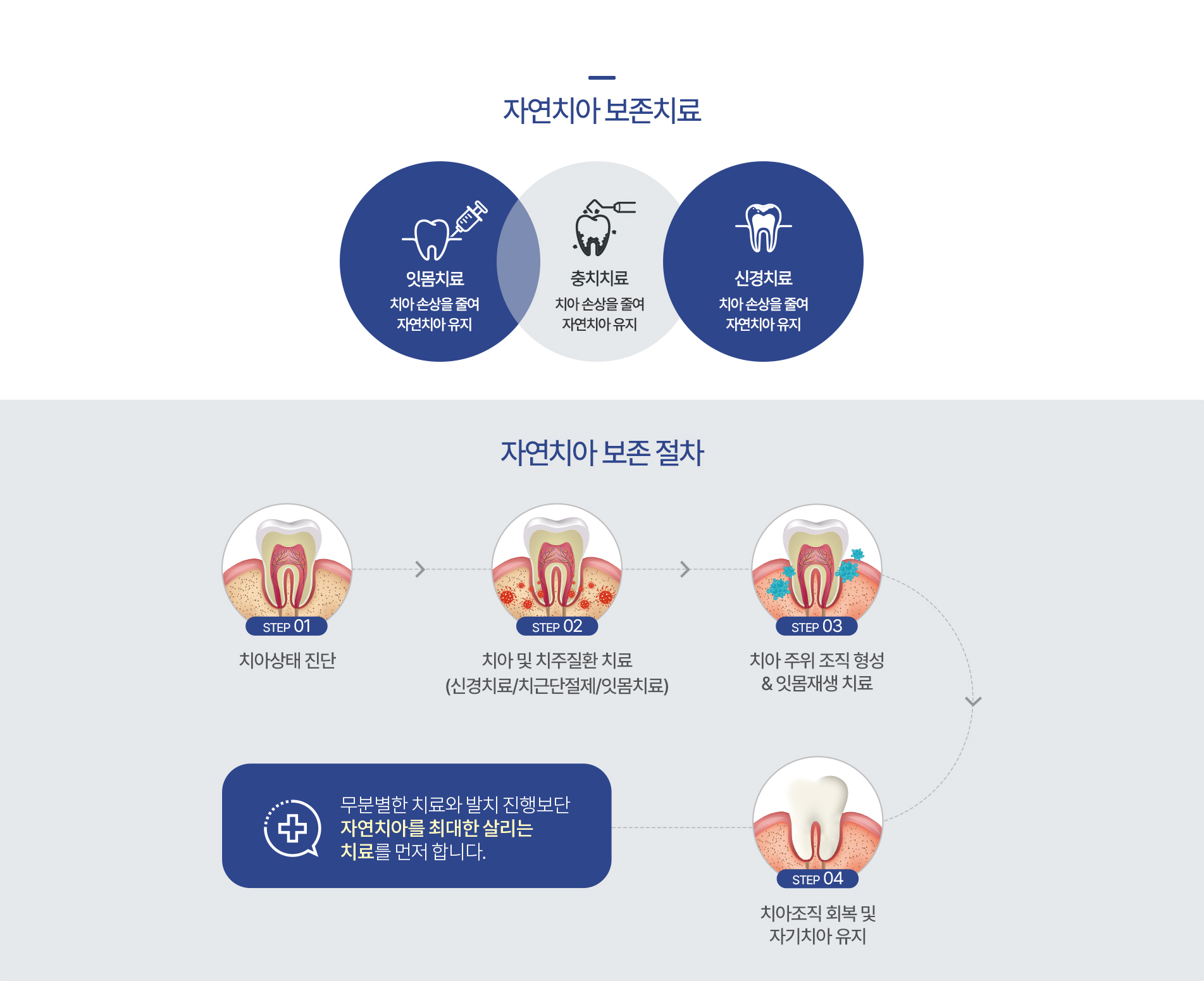 자연치아 보존치료