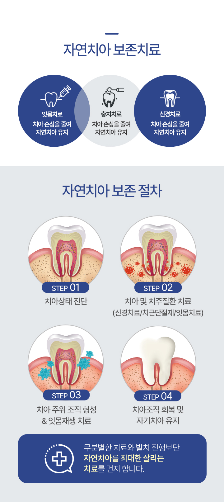 자연치아 보존치료