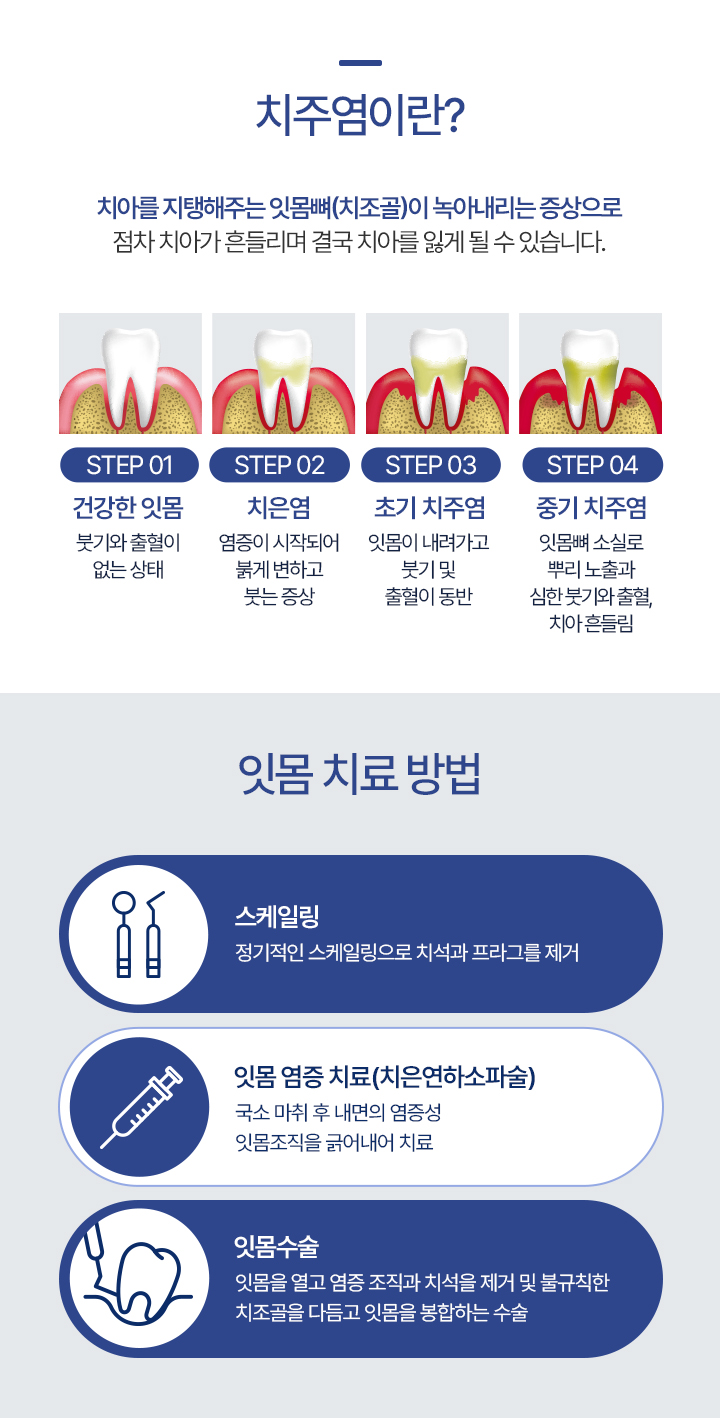 치주염이란?