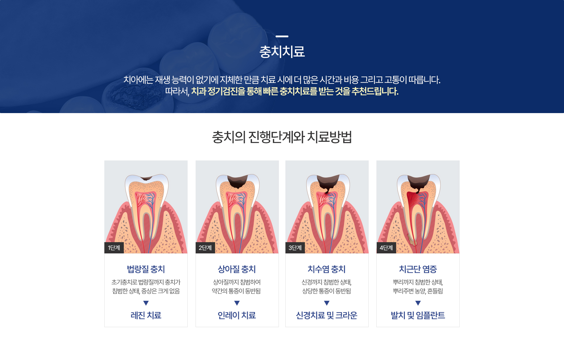 충치치료