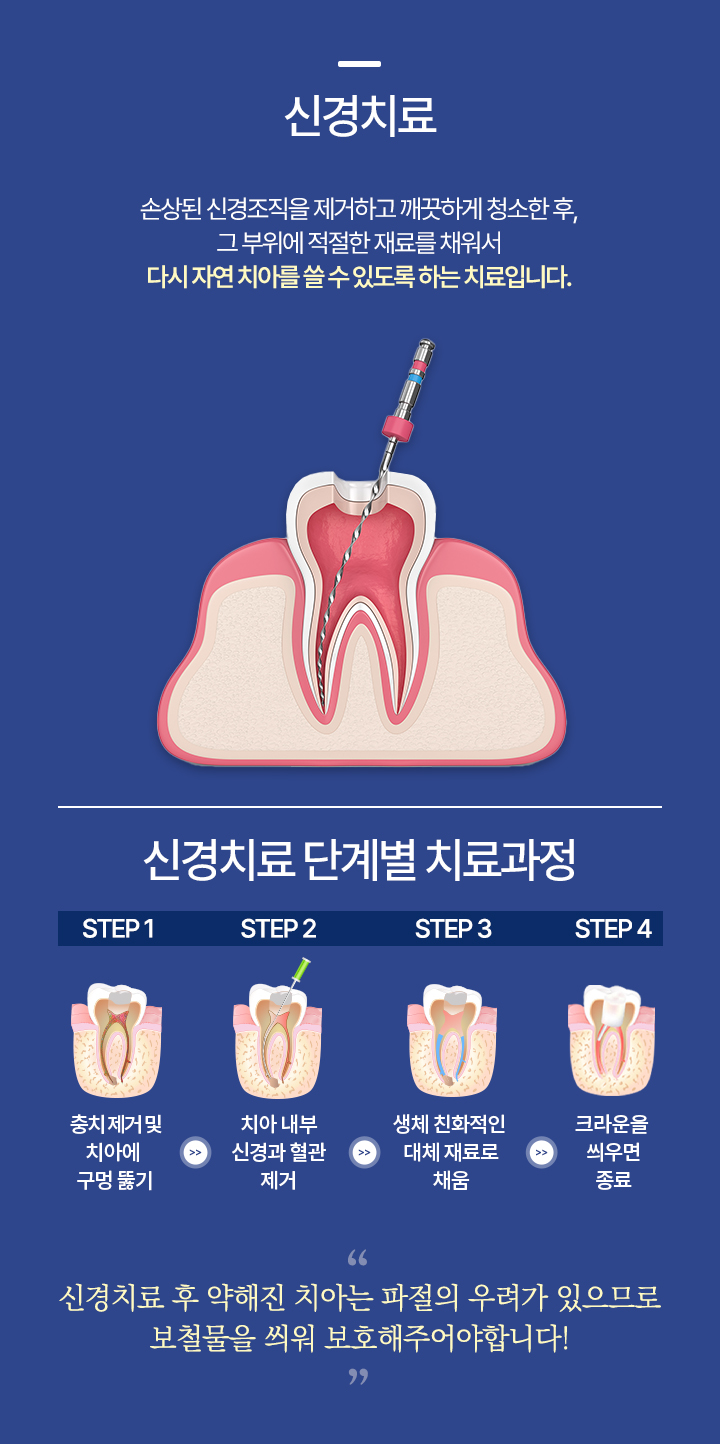 신경치료